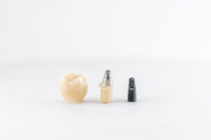 dental implant with screw and crown 2021 04 13 04 26 38 utc 1