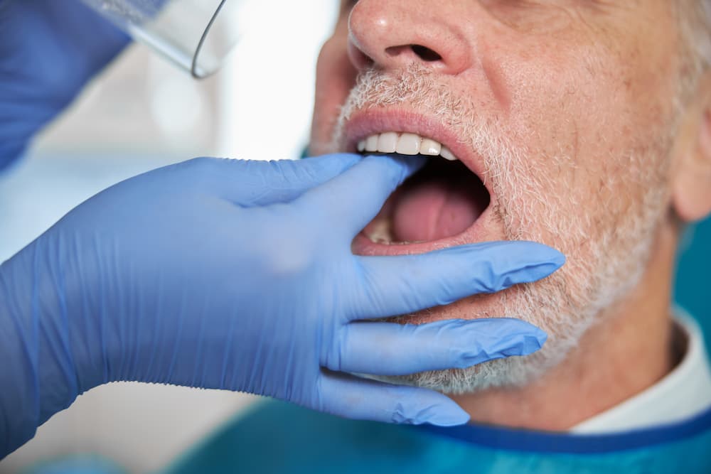 Read more about the article 上顎植牙地雷多，醫師與患者需要注意甚麼？