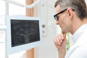 male dentist looking teeth on digital x ray comput 2021 08 26 18 19 45 utc 1